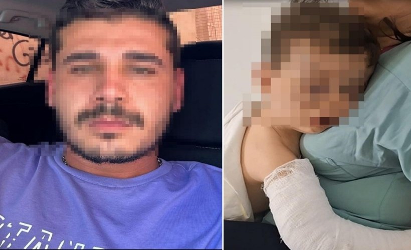 2 yaşındaki bebeğe vahşeti yaşattı! Çocuk yoğun bakımda, anne ile sevgilisi gözaltında