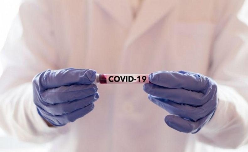 4 Eylül corona virüsü verileri açıklandı: 53 can kaybı, 1612 vaka
