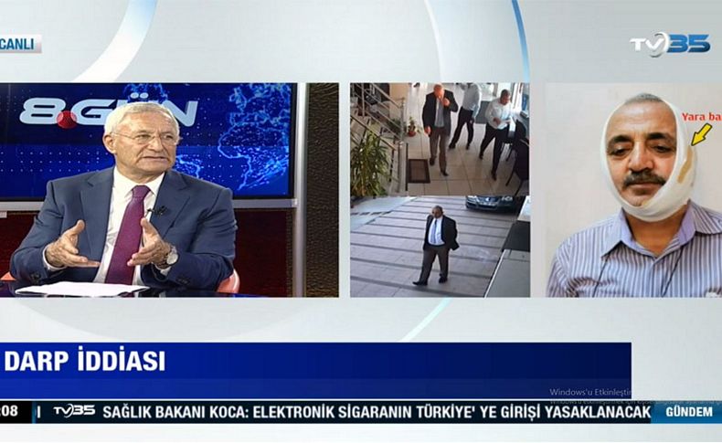 Celil Anık'tan TV35'te flaş açıklamalar: Sargı bezinde yara bandı mı kullanılır