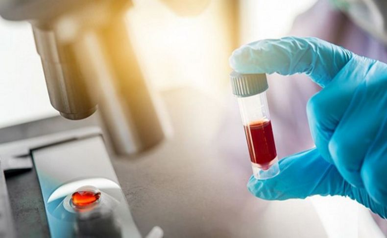 Ege Üniversitesi laboratuvarı 4 binden fazla örnek üzerinde antikor testi yapacak