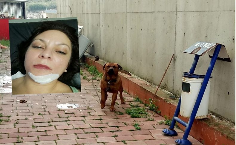 İş görüşmesine giden kadına köpek saldırdı