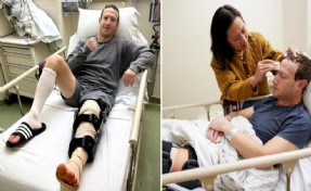 Mark Zuckerberg MMA dövüşüne hazırlanırken hastanelik oldu