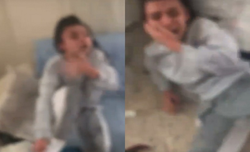 Kız kardeşinin üzerine kaynar su döküp internette paylaşmıştı... Baba-oğul tutuklandı!