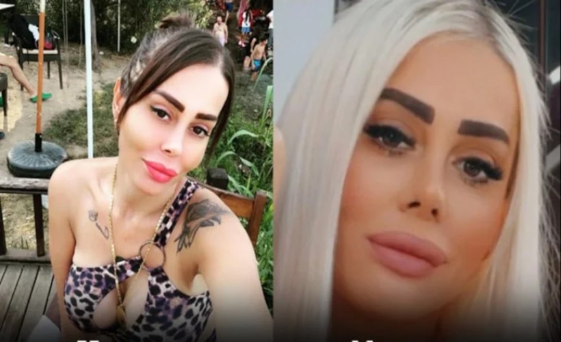 Güzellik uğruna can verdi