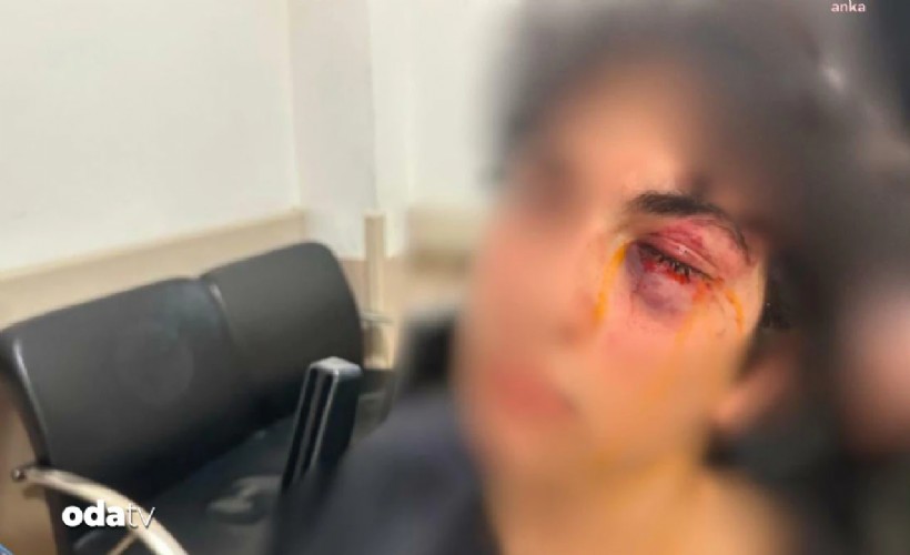 CHP standına saldırı: 15 yaşındaki çocuğu öldüresiye darbettiler