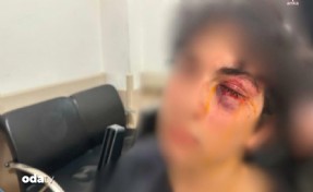 CHP standına saldırı: 15 yaşındaki çocuğu öldüresiye darbettiler