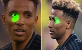 Fernandes'in gözüne lazer tutan seyirci gözaltına alındı