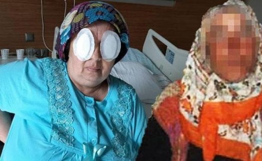 Şizofreni hastası kadın dehşet saçtı: Birinin daha gözünü oydu!