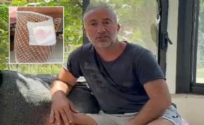 Yürüyüş yaparken köpek saldırısında yaralandı