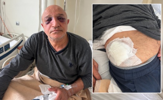 İzmir'de oda başkanına evinin önünde silahlı ve bıçaklı saldırı