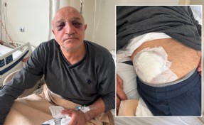 İzmir'de oda başkanına evinin önünde silahlı ve bıçaklı saldırı
