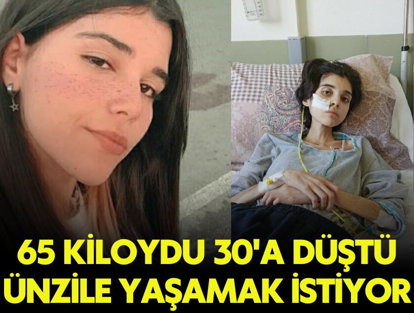 Ünzile yaşam savaşında destek bekliyor: 65 kilodan 30'a düştü