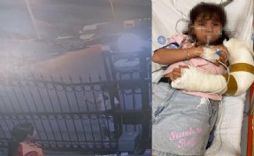 11 yaşındaki çocuğun kolu sürgülü kapıya sıkışıp kırıldı; aile şikayetçi oldu