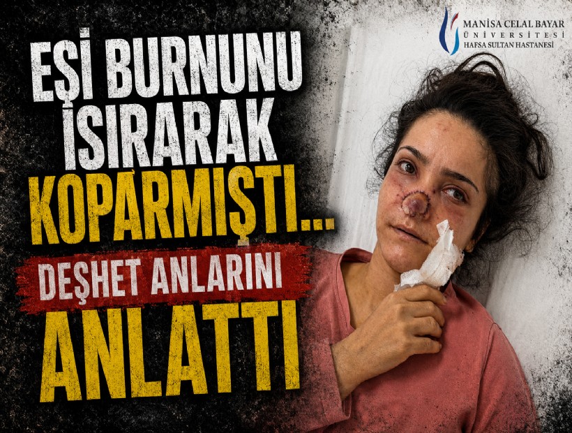 Eşi burnunu ısırarak koparmıştı... Deşhet anlarını anlattı