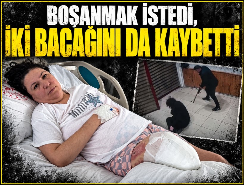 Boşanmak istedi, iki bacağını da kaybetti