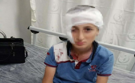 Mahkeme kalıcı izi dikkate aldı: Köpek sahibine 1 milyon 200 bin TL tazminat