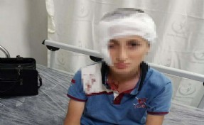 Mahkeme kalıcı izi dikkate aldı: Köpek sahibine 1 milyon 200 bin TL tazminat
