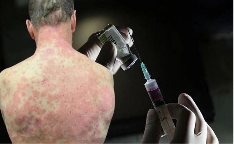Korona aşısında 'yan etki' kâbusu