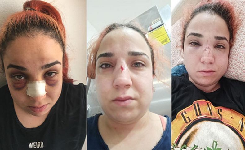 İzmir'de kafe çalışanı kadın, patronu tarafından fırça süpürgeyle darbedildi