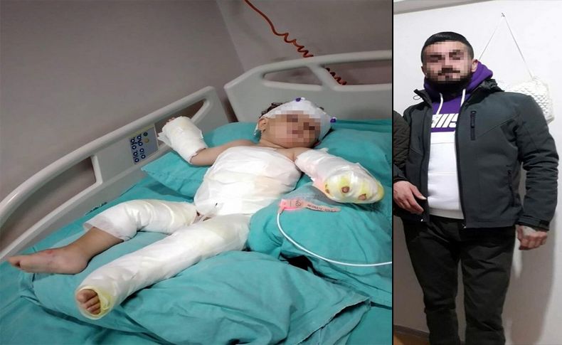 İzmir'de kan donduran olay! Eşi ve 1,5 yaşındaki oğlunu kolonya ile yaktı!