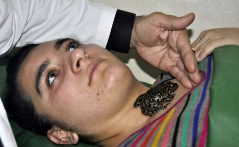 Azerbaycan'da bir klinik guatr hastalarını kurbağa ile tedavi ediyor (Özel)