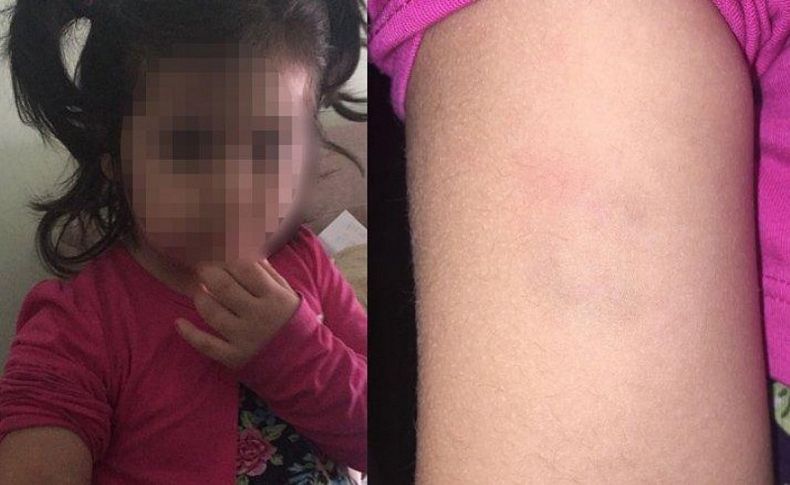 ‘Baba kolum acıyor geçer mi’ diye sorunca ortaya çıktı