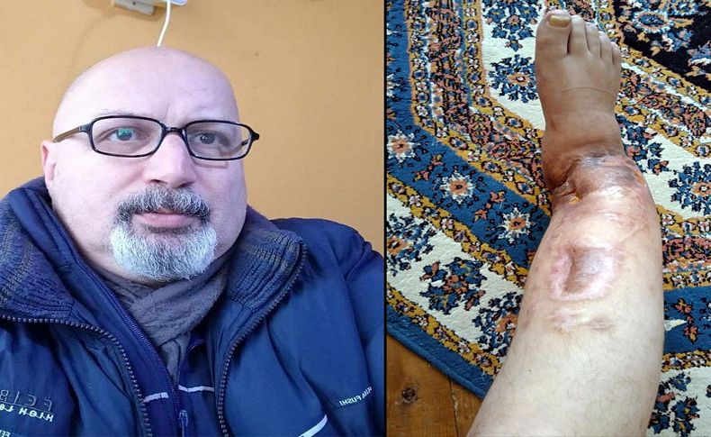 Bacağı kesilecek garsondan, doktor ihmali iddiası