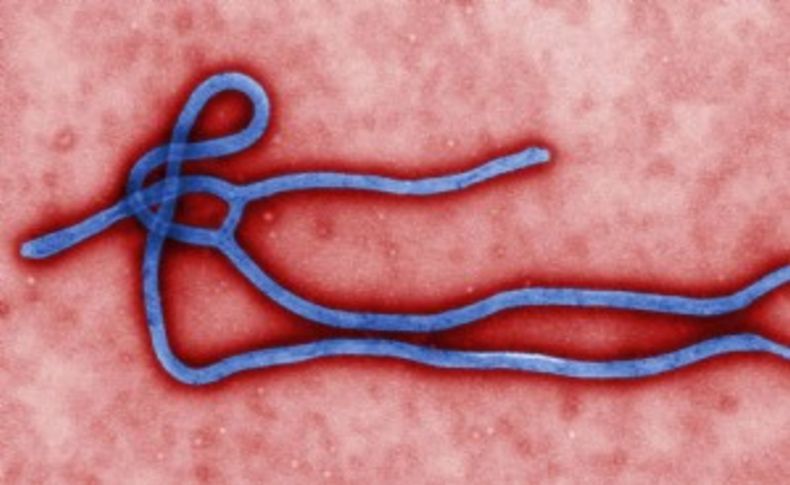 Ebola Türkiye’de var mı'
