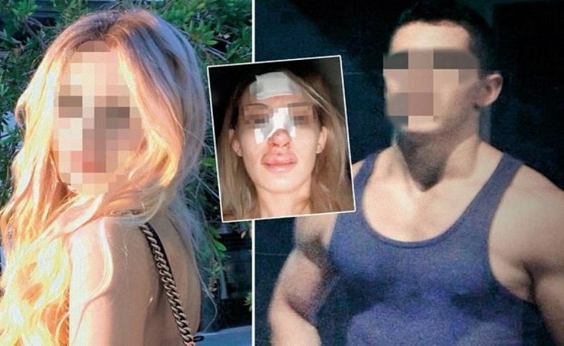Erkek şiddetine isyan ve itiraz: Ölmem mi gerekiyor