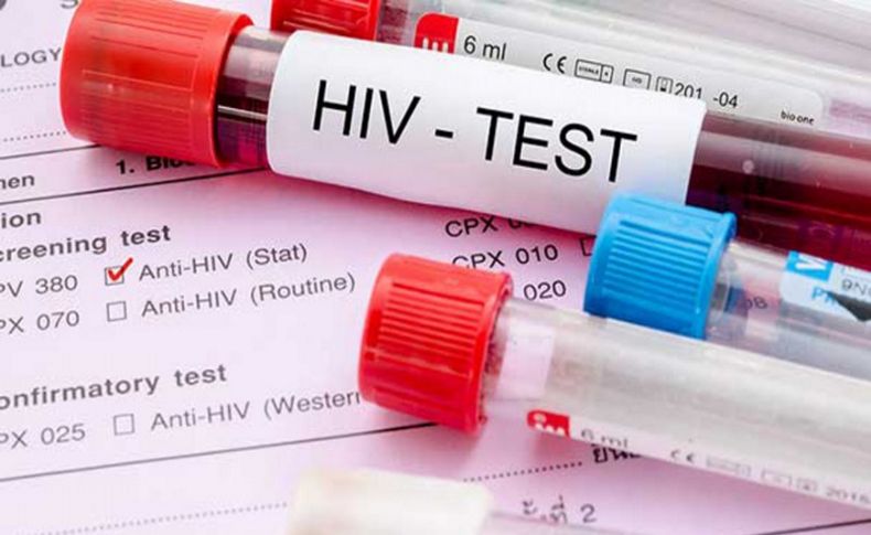 HIV testinde nelere dikkat edilmeli'