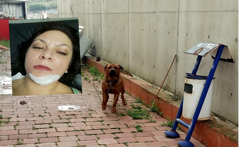 İş görüşmesine giden kadına köpek saldırdı