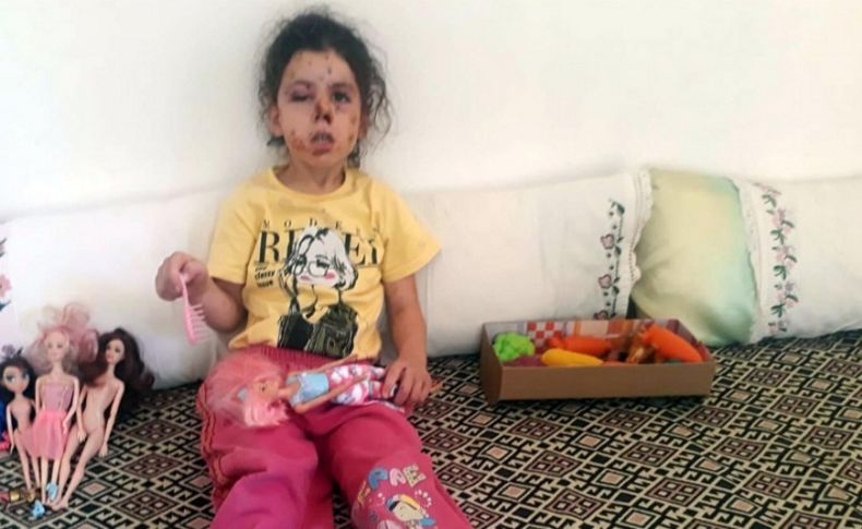 İzmir'de düğün konvoyundan açılan ateş sonucu 5 yaşındaki kız çocuğu yaralandı