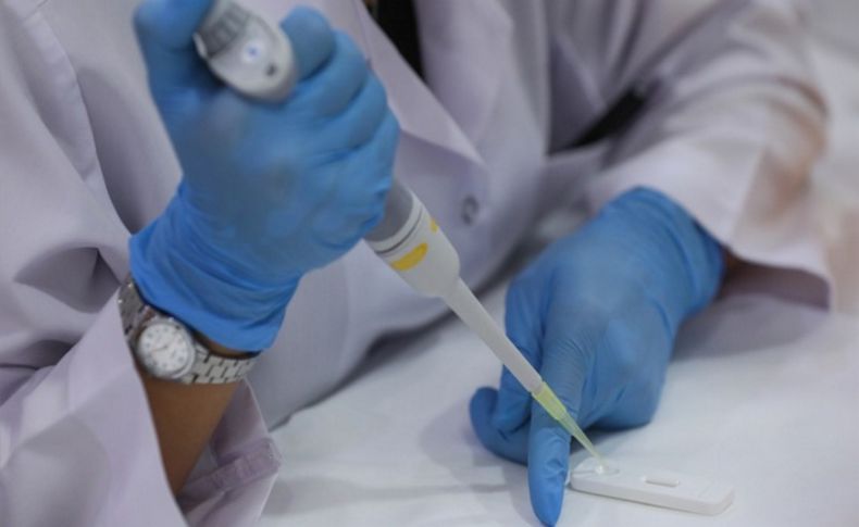 İzmir'de geliştirilen yerli antikor testi yaklaşık 50 ülkeye ihraç edildi