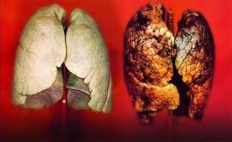 Sigara içenlerde kanser riski çok yüksek