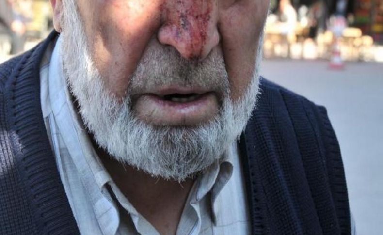 Koçun Boynuzuyla Hastanelik Oldu