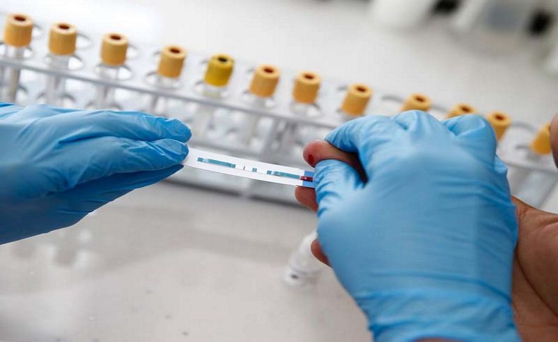 Konak Belediyesi’nden ücretsiz ve anonim HIV testi