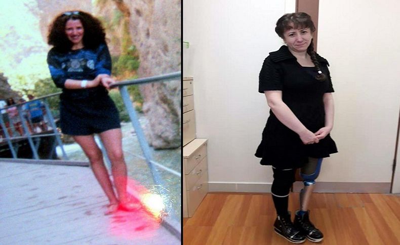Lale kopan bacağının diyetini istiyor