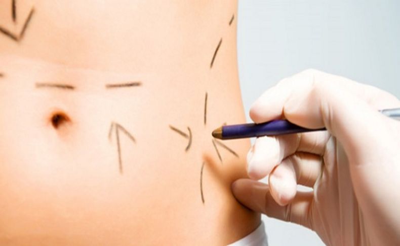 Liposuction operasyonu hakkında her şey