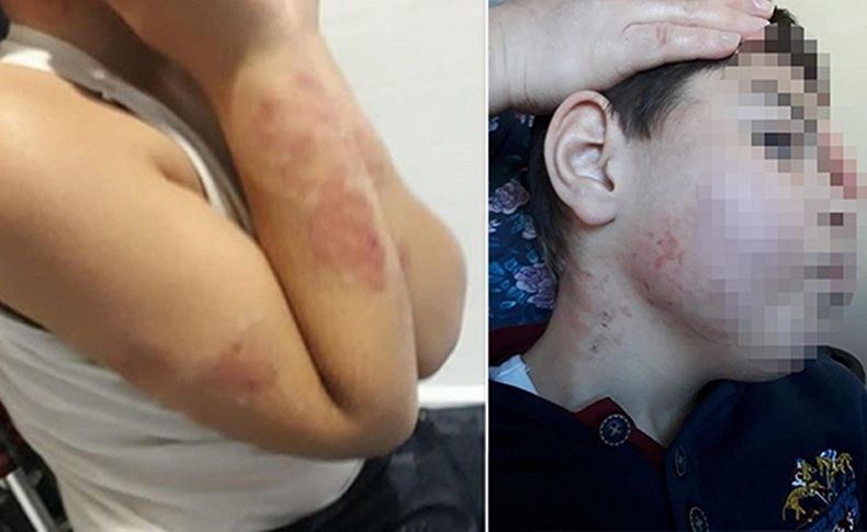 Özel rehabilitasyon merkezinde 10 yaşındaki çocuğa 'darp' iddiası