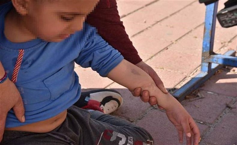 Skandal iddia: 5 yaşındaki zihinsel engelli çocuğa okulda şiddet